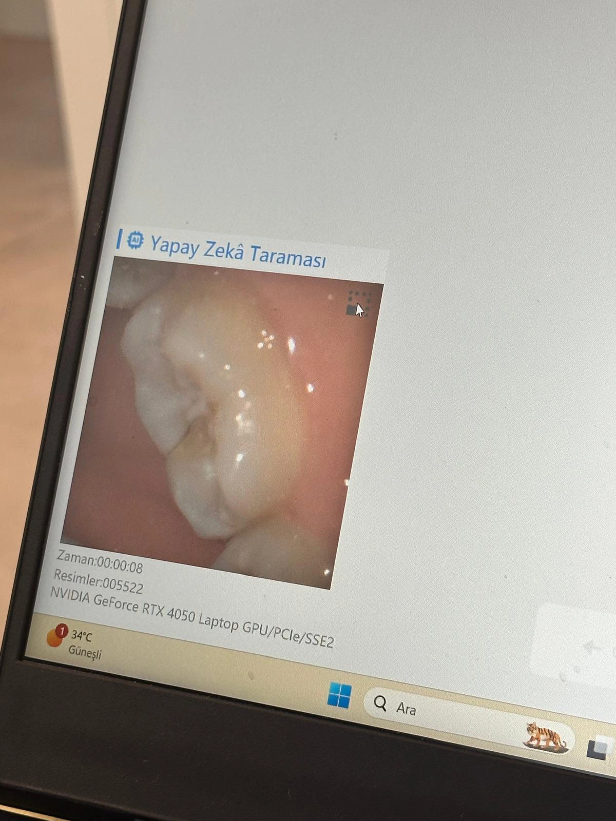 dentalpin-diş-aletleri-23